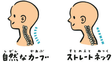 どうして眠れるもりの枕がストレートネックに効果的なのか